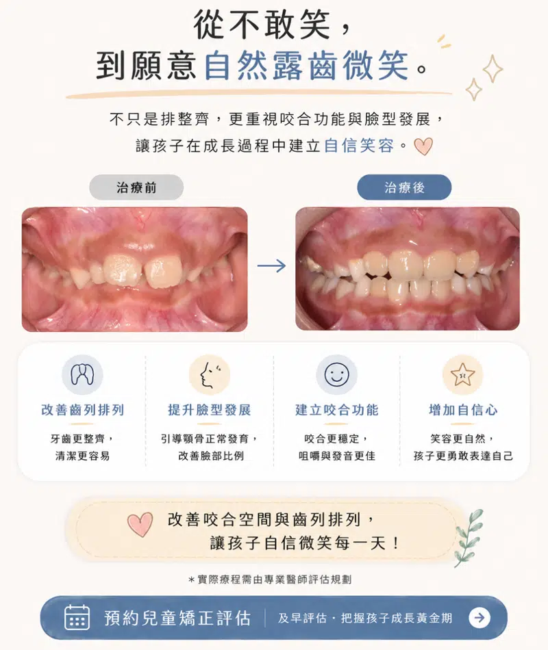 兒童MRC矯正 兒童MRC矯正