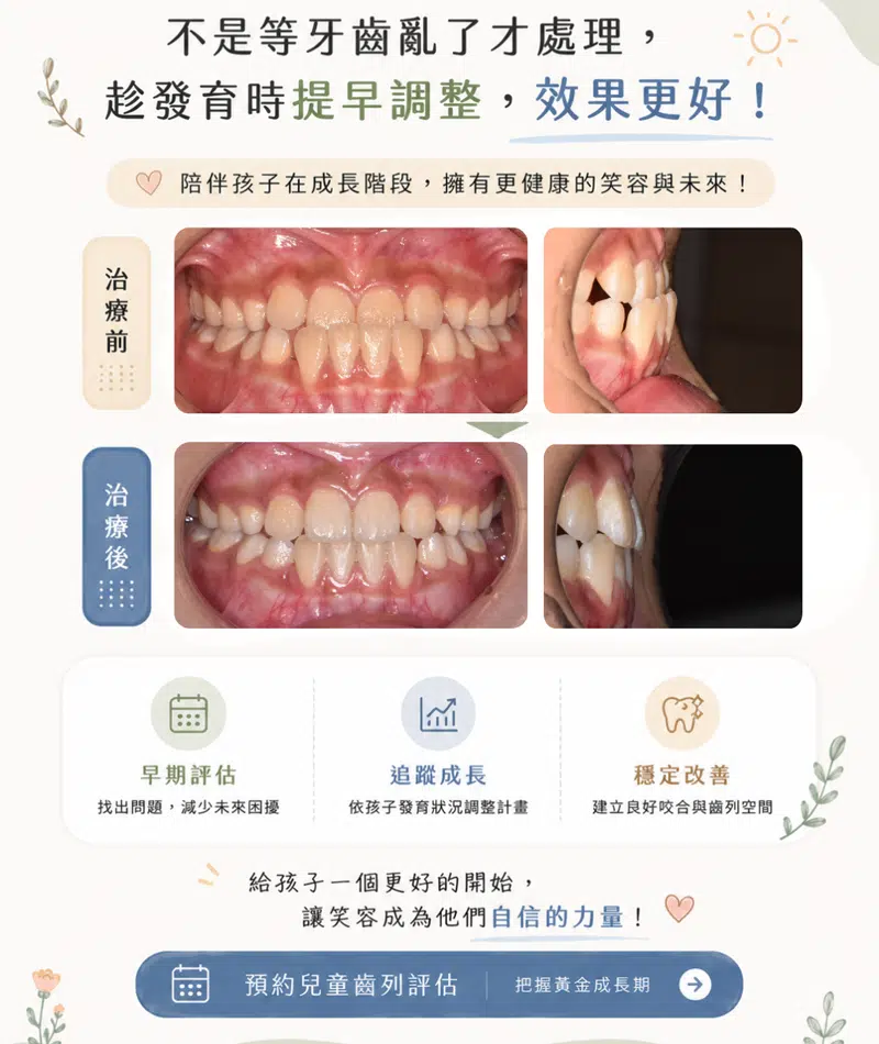 兒童MRC矯正 兒童MRC矯正